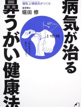 よくわかる最新療法 病気が治る鼻うがい健康法 体の不調は慢性上咽頭炎がつくる